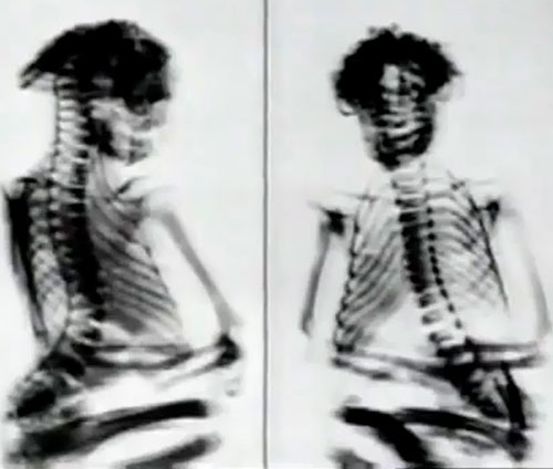 xraysofmummy.jpg